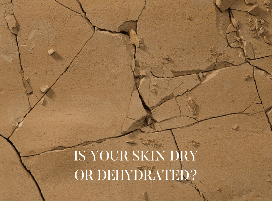 Is Your Skin Dehydrated?