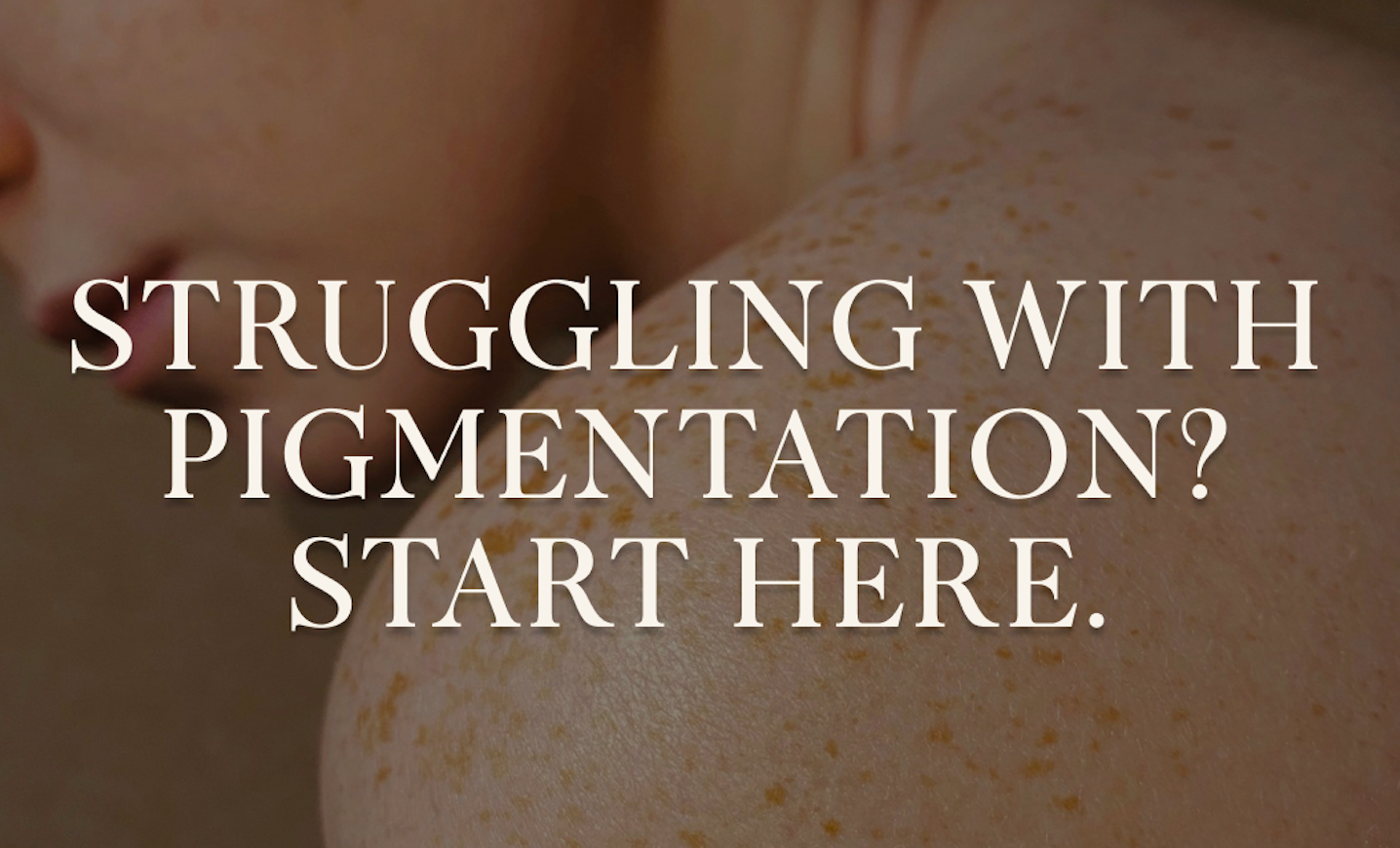 Struggling with pigmentation?